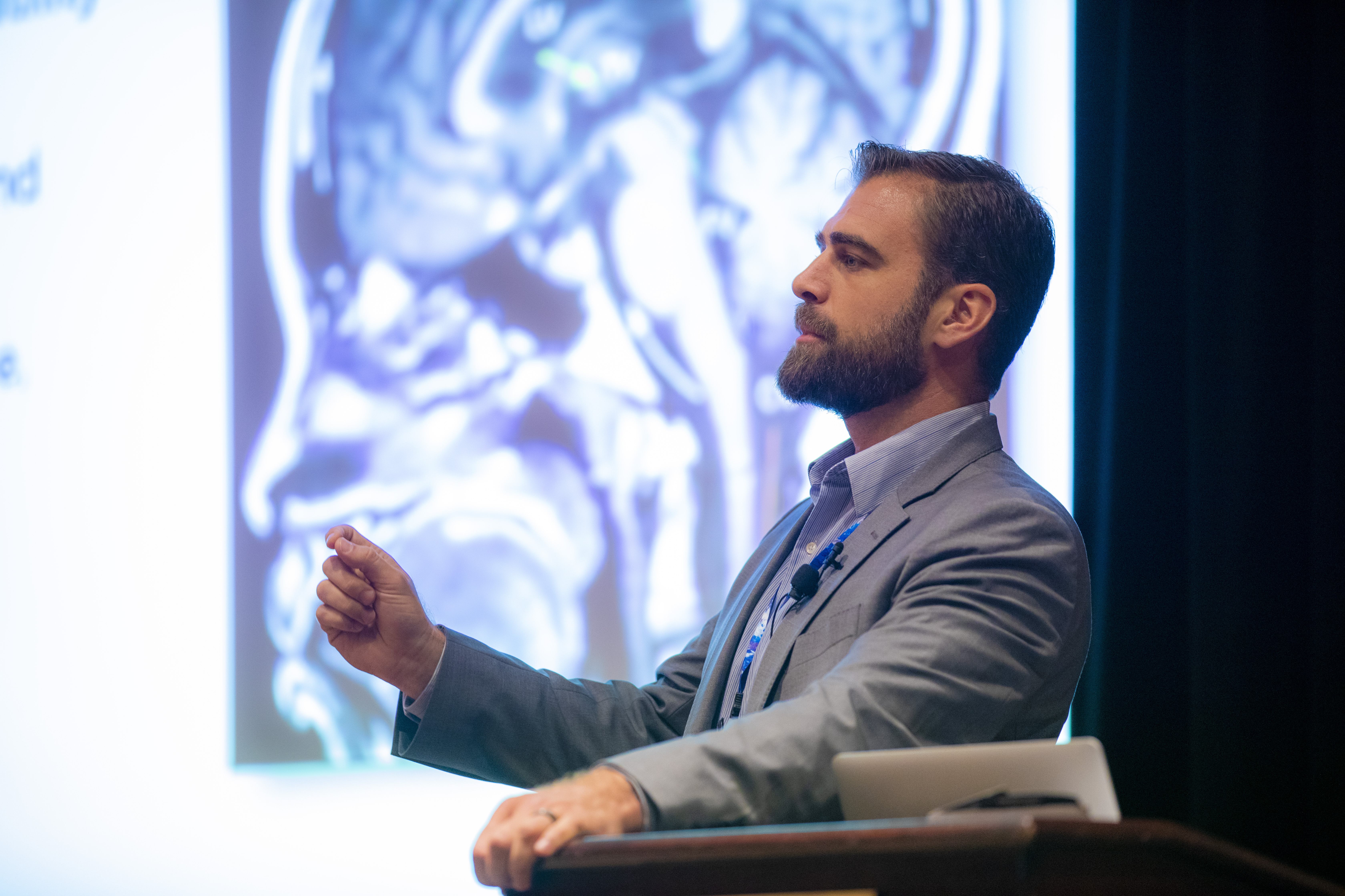 Dr. Chris Slininger presenting at a lectern with a brain MRI on the screen behind him — Denver conference on brain health and mTBI
